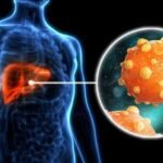 Gejala Hepatitis B yang Sering Dianggap Masuk Angin, Padahal Bisa Menyerang Hati