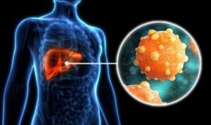 Gejala Hepatitis B yang Sering Dianggap Masuk Angin, Padahal Bisa Menyerang Hati