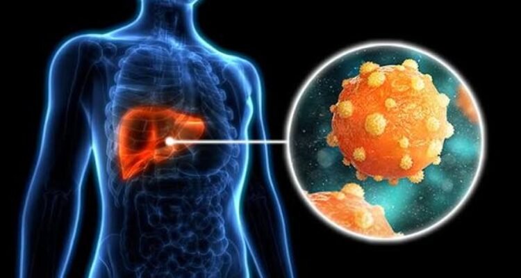 Gejala Hepatitis B yang Sering Dianggap Masuk Angin, Padahal Bisa Menyerang Hati