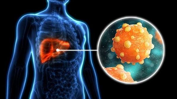 Gejala Hepatitis B yang Sering Dianggap Masuk Angin, Padahal Bisa Menyerang Hati